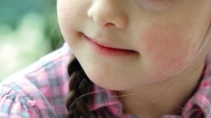 NK Čelik i Institut za zdravlje i sigurnost hrane obilježavaju Dan osoba sa Down sindromom